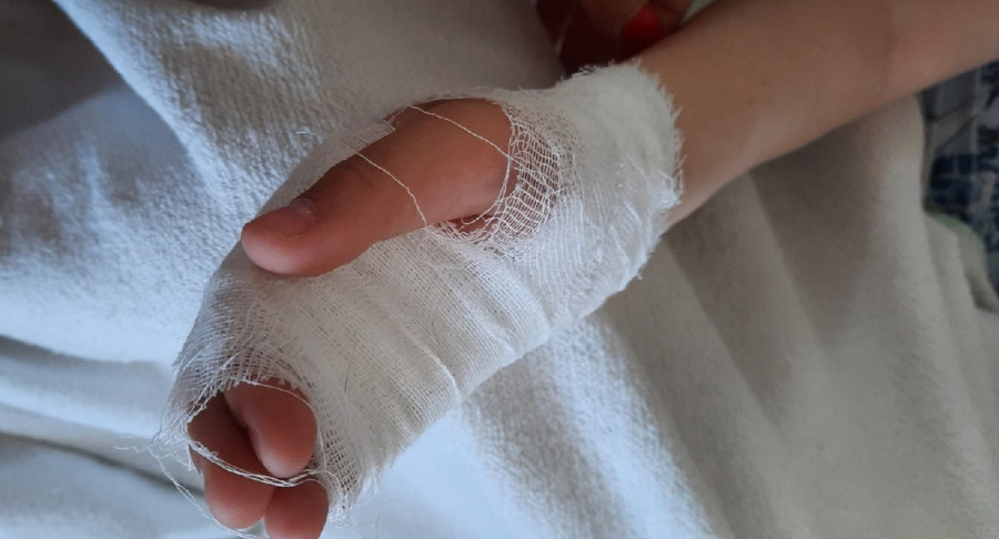 Севастопольский малыш получил рваную рану на детской горке